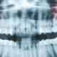 Illustration for article titled Dentists Found a Pain-Free Cavity Fix That Might Actually Work